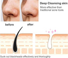 Derma Suction Blackhead Remover Rechargeable Vacuum Pore Cleaner Facial Beauty Device